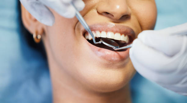 Best Urgent Care for Lost Fillings or Crowns in Mp Pendleton South, CA